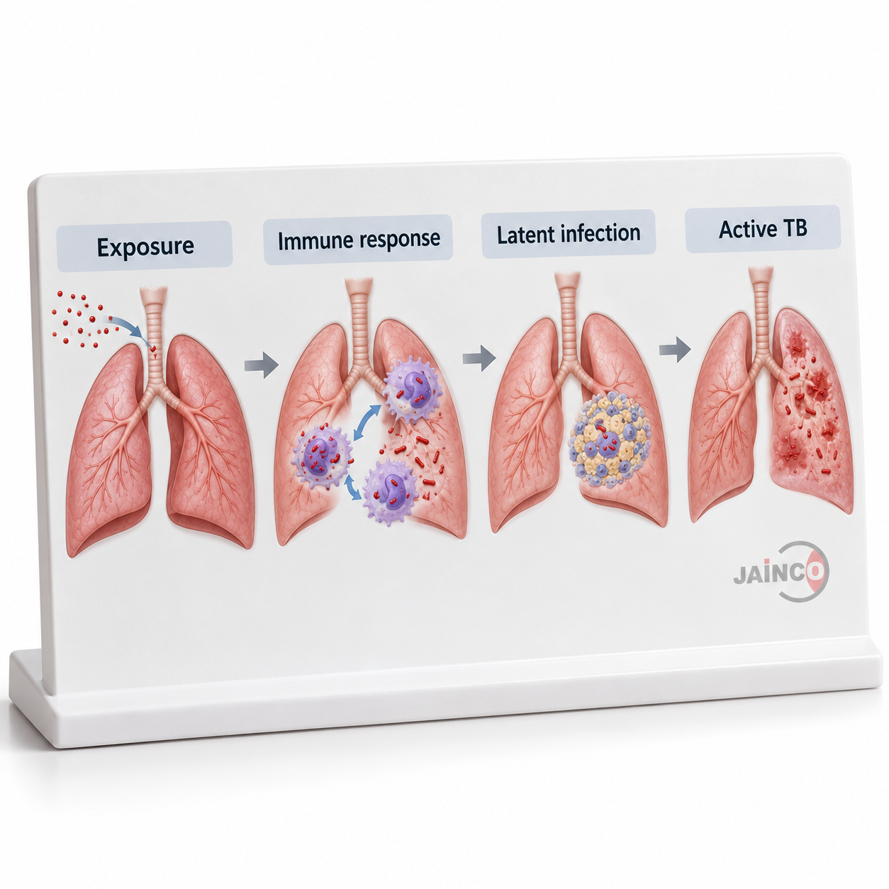 T.B. Infection Model